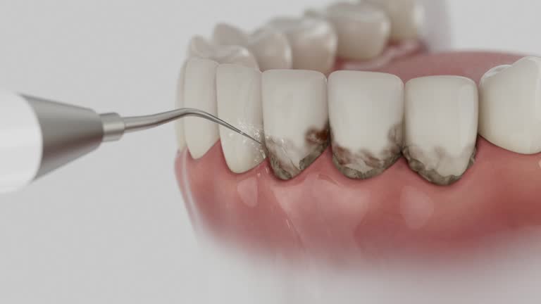 Trusted Teeth Cleaning And Checkup service in Chetopa, KS - Dentist Open Now